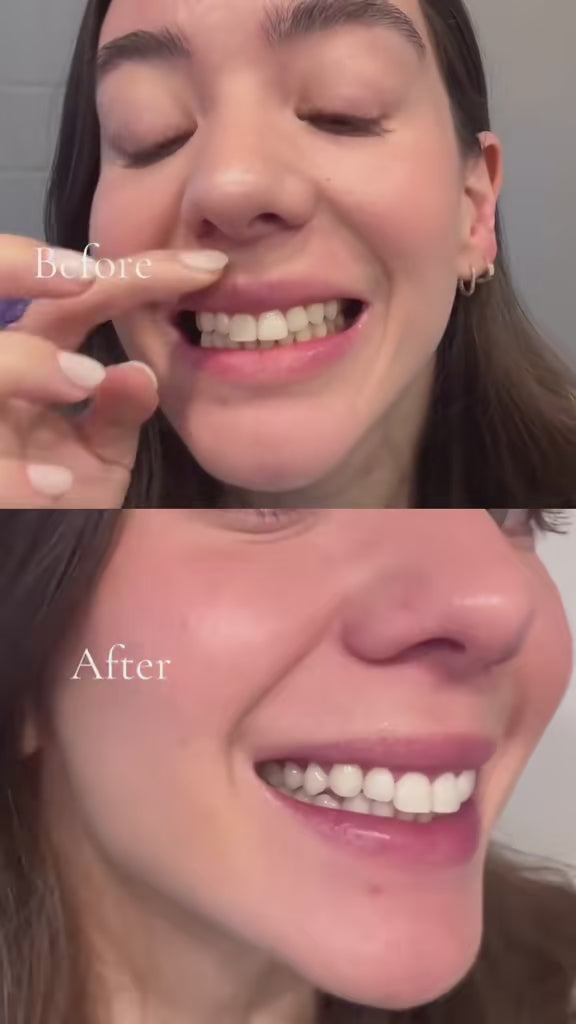 Video UGC Antes y después del Serum corrector de color V34 morado sin peróxido de Hismile